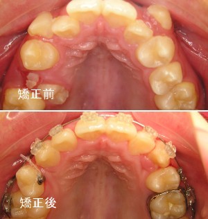 岡山県で矯正歯科