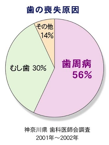 虫歯と歯周病